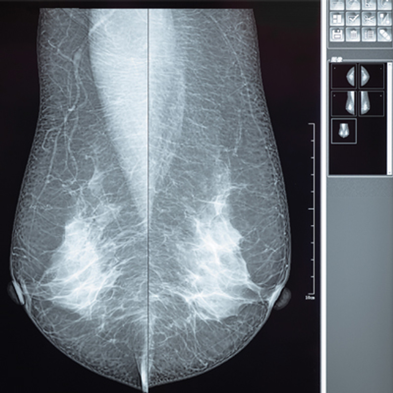 Imaging　of　Breast　Comprehensive　CME　Review　Radiology