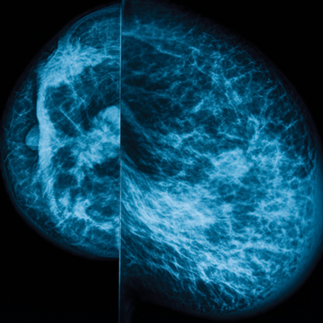 UCSF Breast Imaging - Oakstone | CME