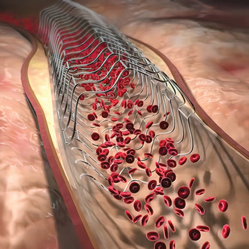 Stay up-to-date on interventional cardiology advances. Enrich your knowledge.