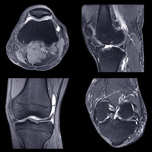 photo of musculoskeletal xrays