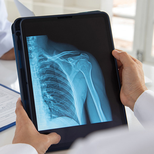 X-ray image on a tablet
