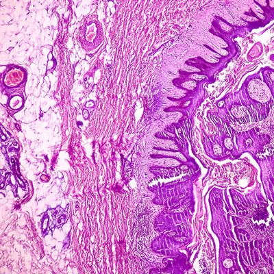 microscopic dermatopathology slide