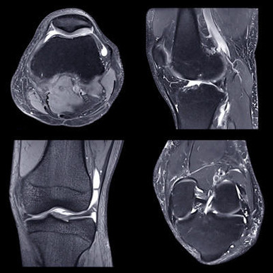 NYU Langone Advanced Imaging of the Musculoskeletal System: Up Your Game