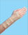 Elastic Wrist Splint