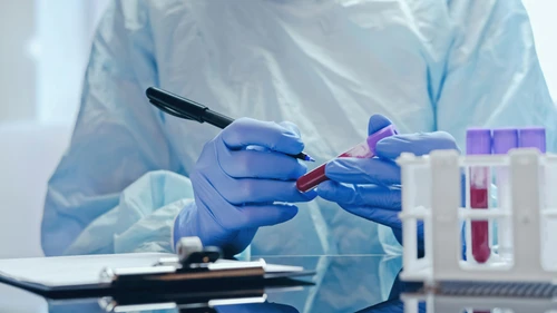 Catecholamine Testing for Cardiovascular Health Assessment