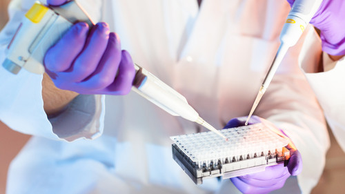 Optimizing Sample Preparation for ELISA Results