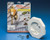 Arlington 8131 5/16" Siding Mounting Kit