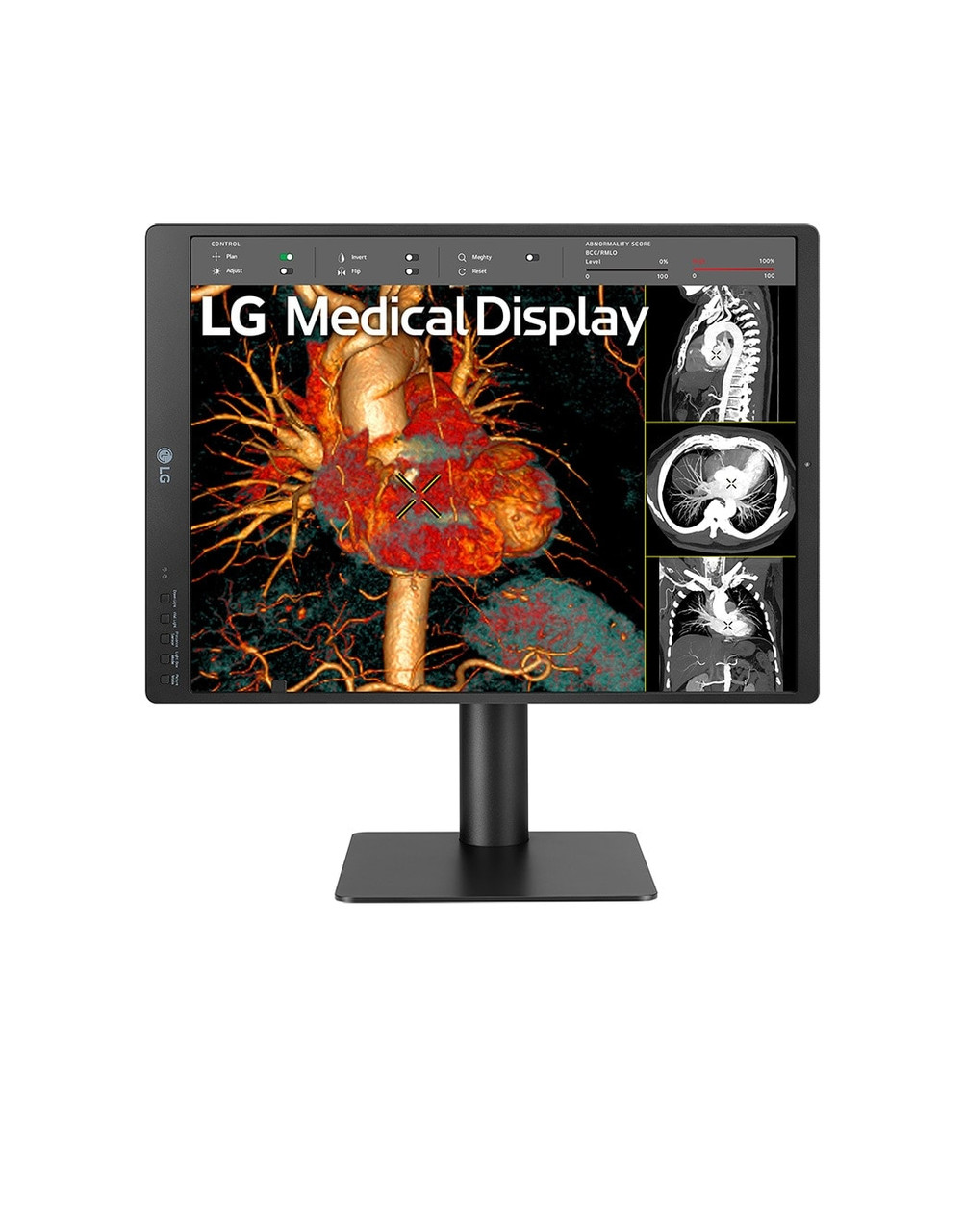 LG 21HQ513D-B/21'' Grayscale 3MP computer monitor 54.1 cm (21.3") 1536 x 2048 pixels HD LCD Black