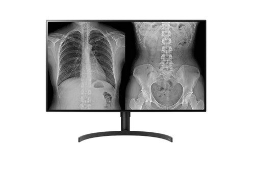 LG 32HL512D-B computer monitor 80 cm (31.5") 3840 x 2160 pixels Full HD Black