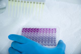 ELISA vs Western Blot: Key Differences, Applications, and Advantages in Protein Detection