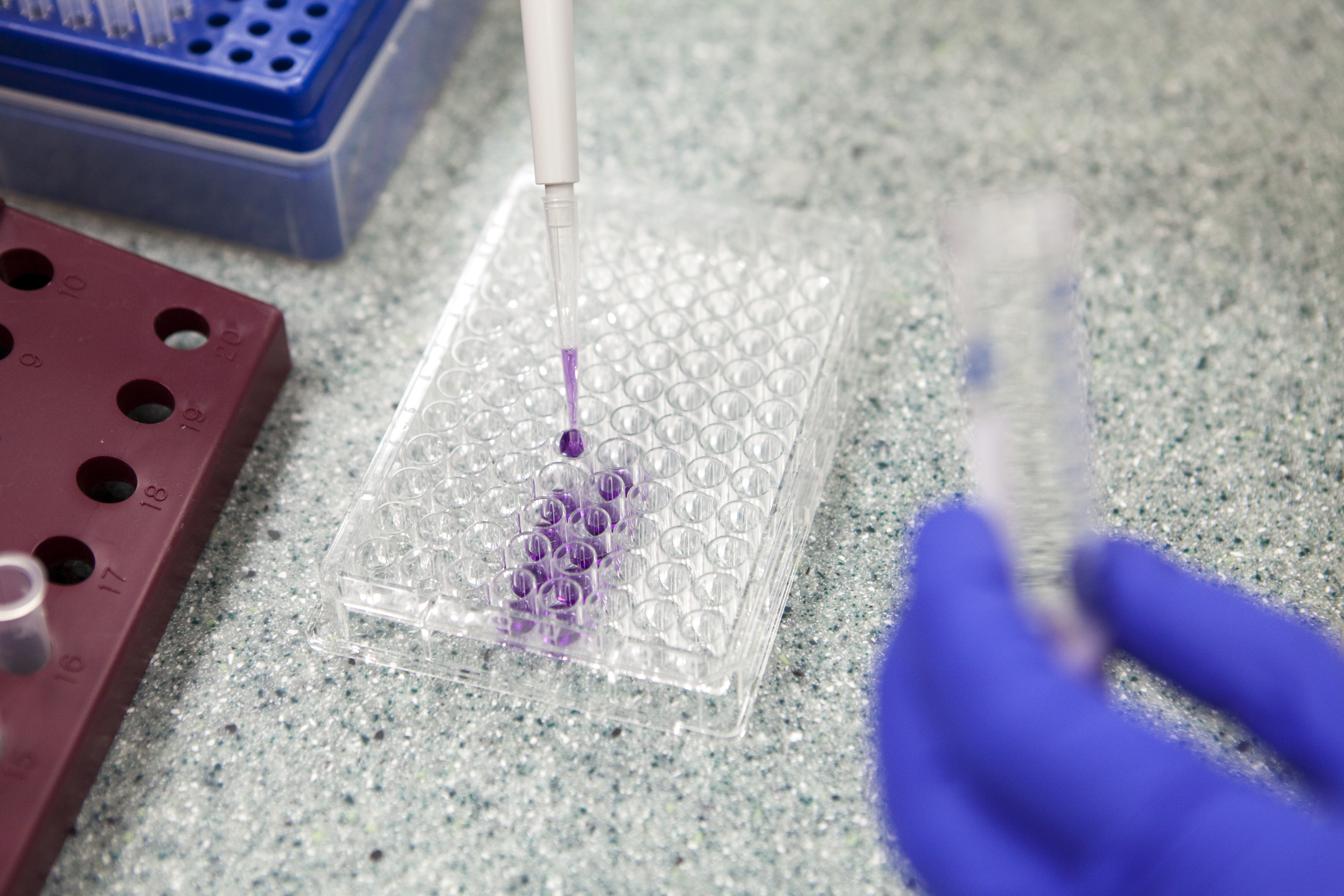 scientist-using-pipette-for ELISA