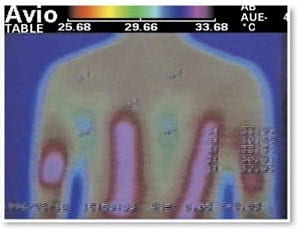 Infrared image of a person's back after using conventional heating pad with little internal heat.