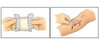 Eclypse CR3863 adherent dressing unfolded showing full 6 x 6 inch square size