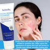 TriDerma Pumping TriDerma redness relief cleanser onto hand – creamy non-drying formula for rosacea-prone skin
