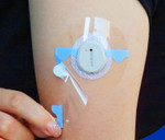 Overt Waterproof, Breathable & Clear Patches for Insulin Pumps, 0.8-Inch Hole [ 5 Pack ]