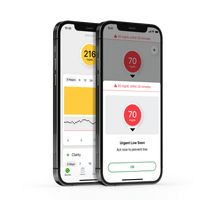 Dexcom G7 All-in-One Sensor and Transmitter - CGM