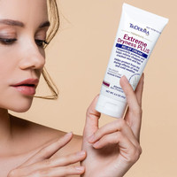 Applying TriDerma extreme dryness cream to dry hands – non-greasy therapeutic formula for chapped, weather-beaten skin