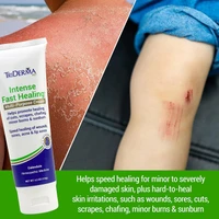 TriDerma intense cream being applied to minor burn – fast-acting relief for hard-to-heal skin irritations