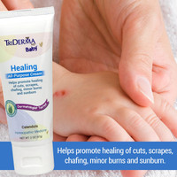 TriDerma baby healing cream being applied to diaper area – non-greasy formula spreads easily and wipes off clean