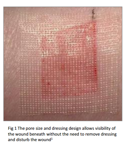 Applying Adaptic non-adhering dressing to wound – prevents dressing adherence and minimizes pain during removal