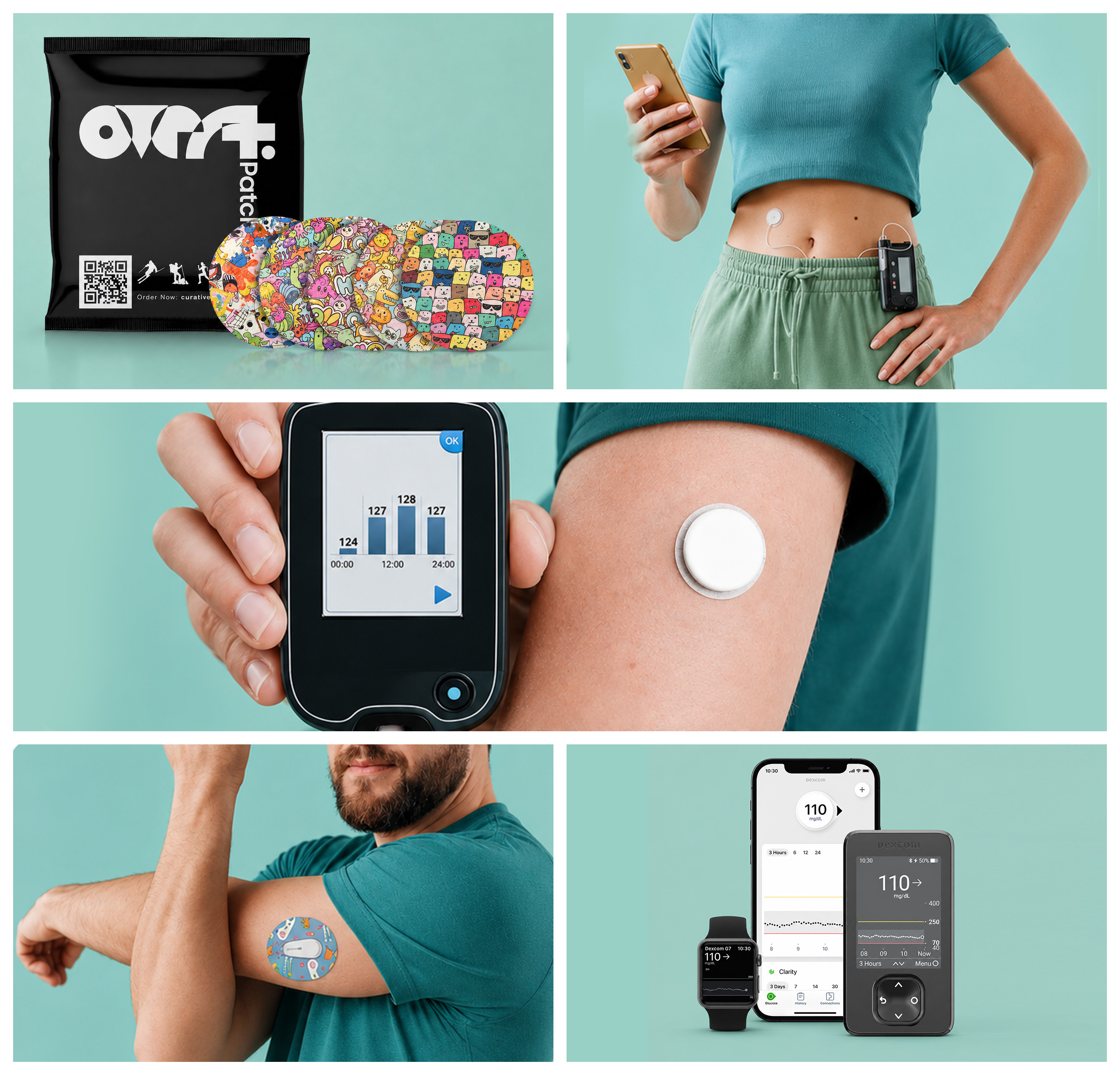 CGM