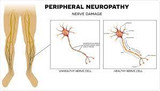 Supplements for Peripheral Neuropathy