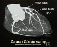 IP6 and Cardiac Calcium