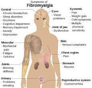 Fibromyalgia Overview