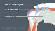 Subacromial Impengement Syndrome