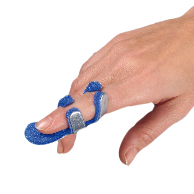 Frog Finger Splint