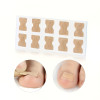 50 Toenail Support Patches for Ingrown Toenails