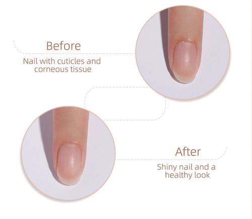 Cuticle Remover Liquid