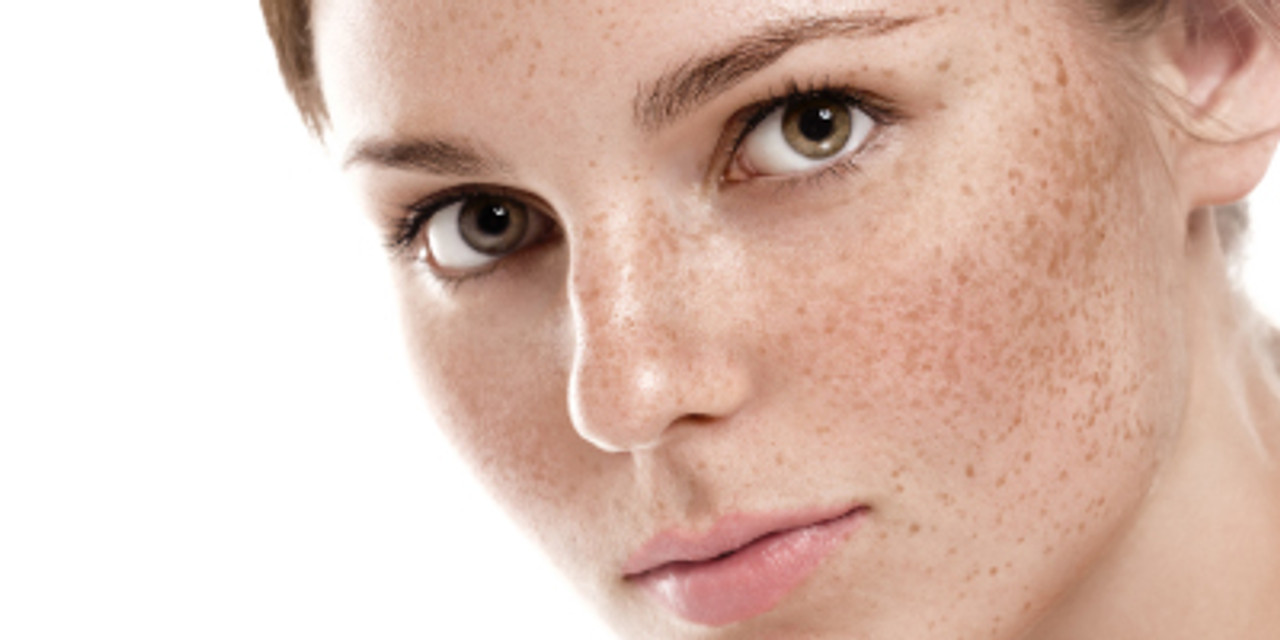 Get Rid Of Hyperpigmentation With These 5 Must-Have Products Get Rid Of Hyperpigmentation With These 5 Must-Have Products