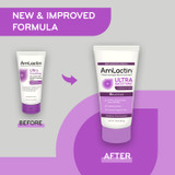 New look for AmLactin Ultra Smoothing  Intensely Hydrating Cream