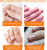 Recommend for nails to use Nail Tek Nail Recovery Kit