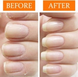 Before and after about Nail Tek Nail Recovery Kit