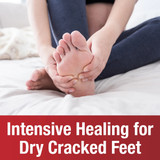 Intensive healing for dry cracked feet