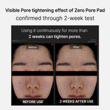 Before and After about Medicube Zero Pore Pads 2.0 70 Sheets