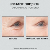Before and After about Peter Thomas Roth Instant Firmx Eye 1 oz