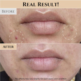 Real results of Beauty of Joseon Glow Replenishing Rice Milk for smoother skin