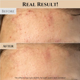 Real results after using Beauty of Joseon rice mask for improved skin texture