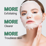 Troubless Clear Whitehead Remover Peel Off Face Mask 5 pcs