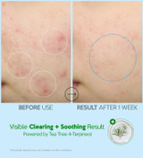 Troubless Hydro Soothing Moisture Cream 2.36 oz