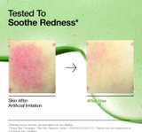 Anua Azelaic Acid 10 Hyaluron Redness Soothing Serum 1.01 oz