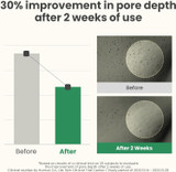 Before and After of AXIS-Y LHA Peel & Fill Pore Balancing Cream 50ml