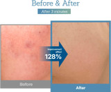 Results of using Blue Centella Calming Cream