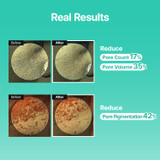 Results of using MEDITHERAPY Porethera Real Bifida Blur Cream