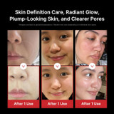 Results of using medicube Age-R Booster Pro device