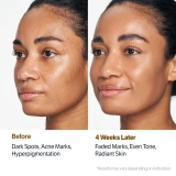 Kojic acid and niacinamide ingredient infographic for dark spot brightening