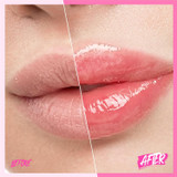 Hydrating glossy lip treatment SKINTIFIC